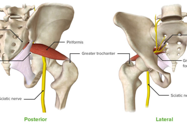 Piriformis-muscle-1200x602