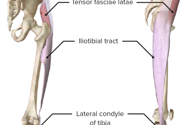 Tensor-fasciae-latae-muscle
